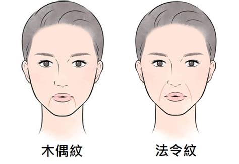 法令紋 木偶紋|木偶紋是什麼？消除木偶紋的5個保養對策、成因與預。